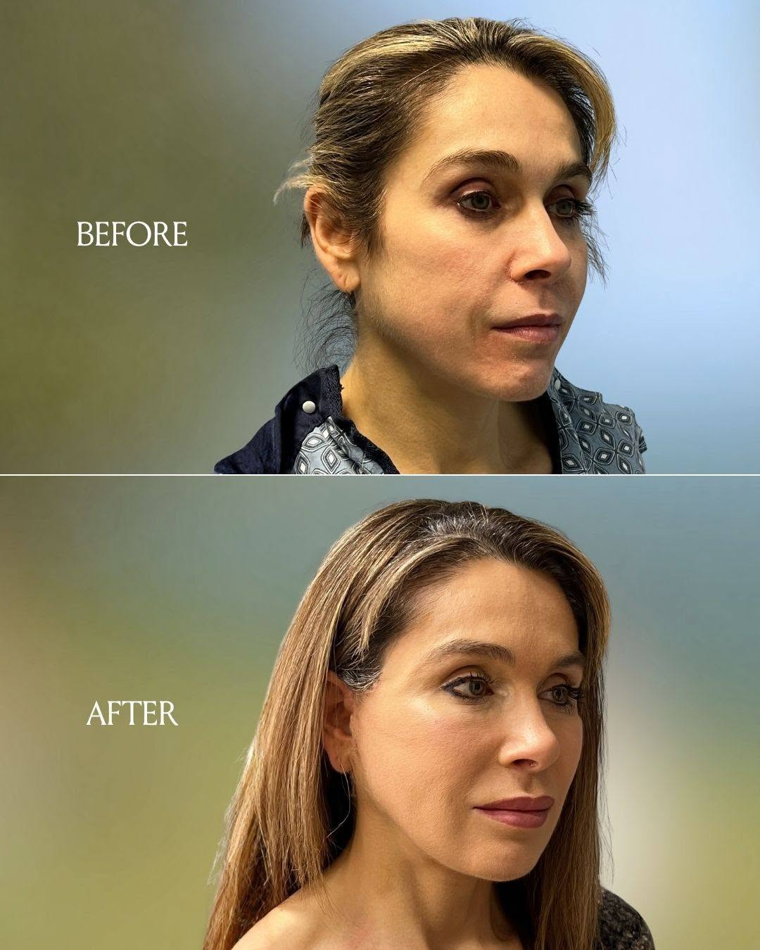 Patient result