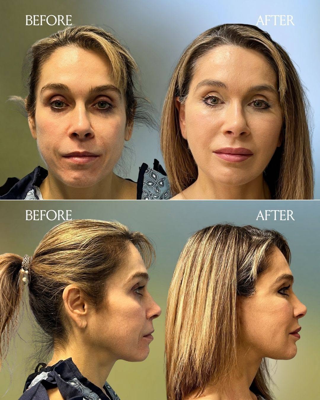 Patient result