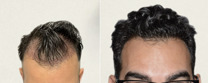 Patient result
