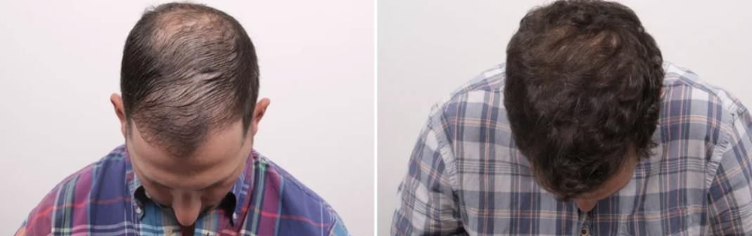 Patient result