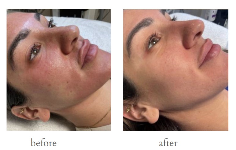 Patient result